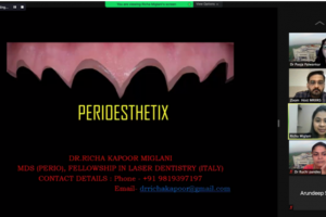 Webinar on ‘Perioesthetics’ in collaboration with Indian Dental Association